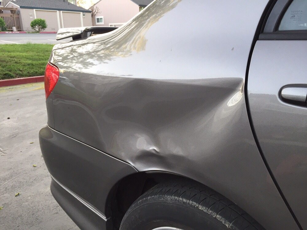 Dent removal